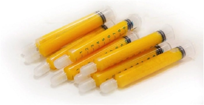 سوالات تزریق چربی