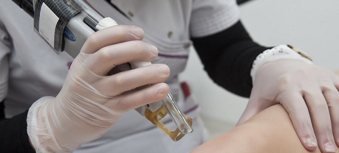 لیزر الکساندرایت مزایای لیزر موهای زائد با دستگاه الکساندرایت