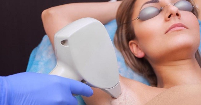 لیزر موهای زائد زیر بغل چند جلسه برای لیزر موی زیر بغل لازم است؟